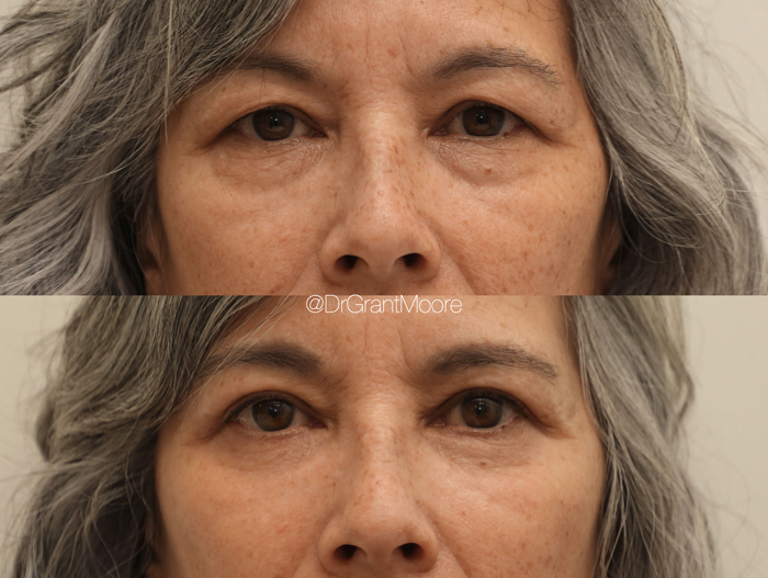 Before and After 2