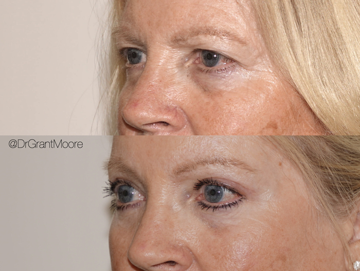 Before and After 2