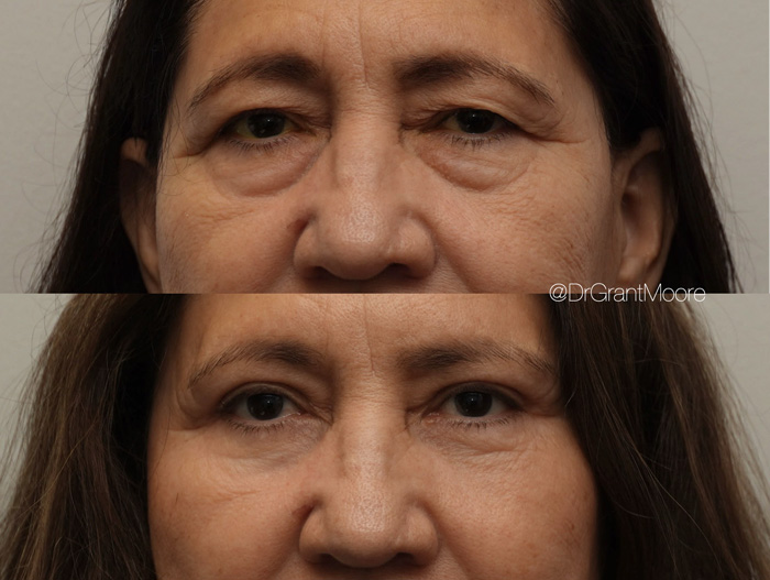 Before and After 2