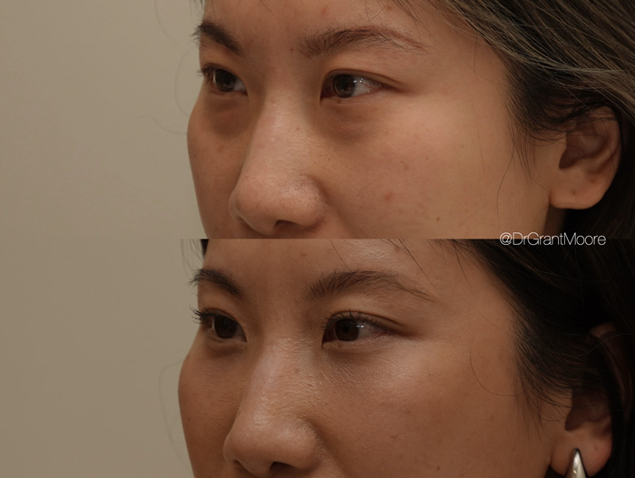 Before and After 2